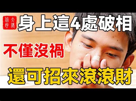 額頭破相|【額頭破相】額頭破相大哉相！不能忽視的4種黴運徵兆